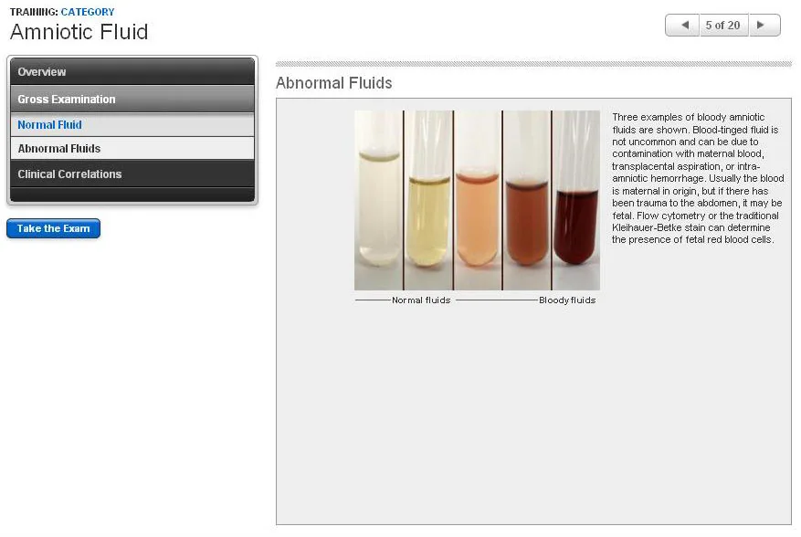 Amniotic Fluid Color Indicators