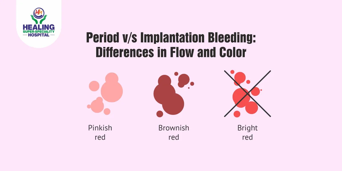 implantation bleeding vs period