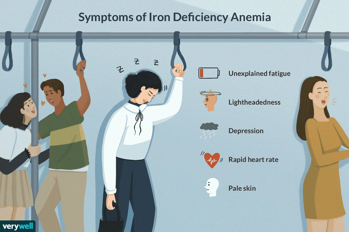 Iron Deficiency Anemia