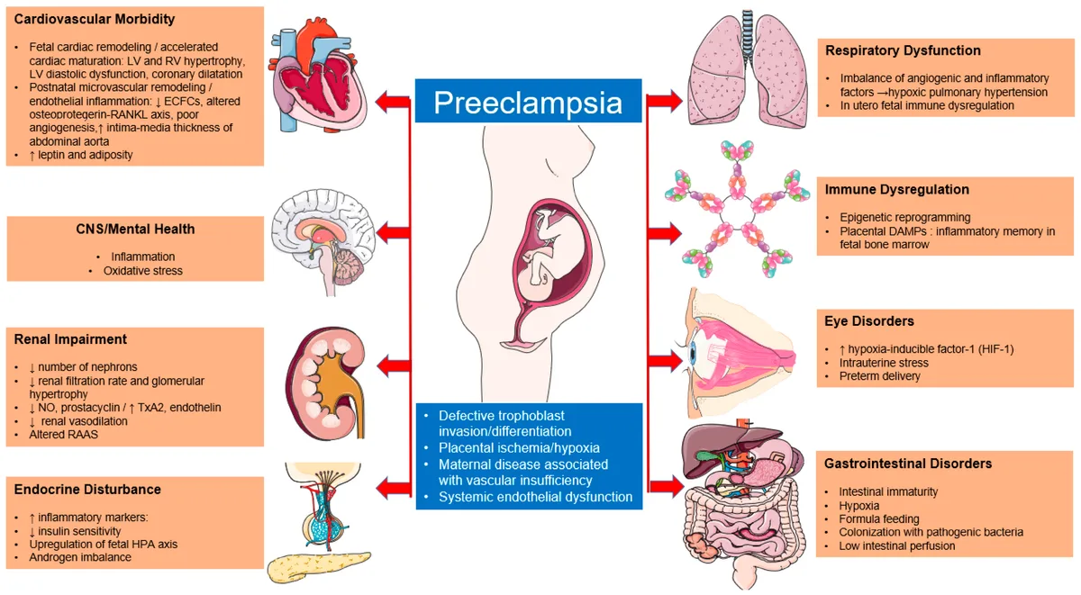 preeclampsia warning signs diagram